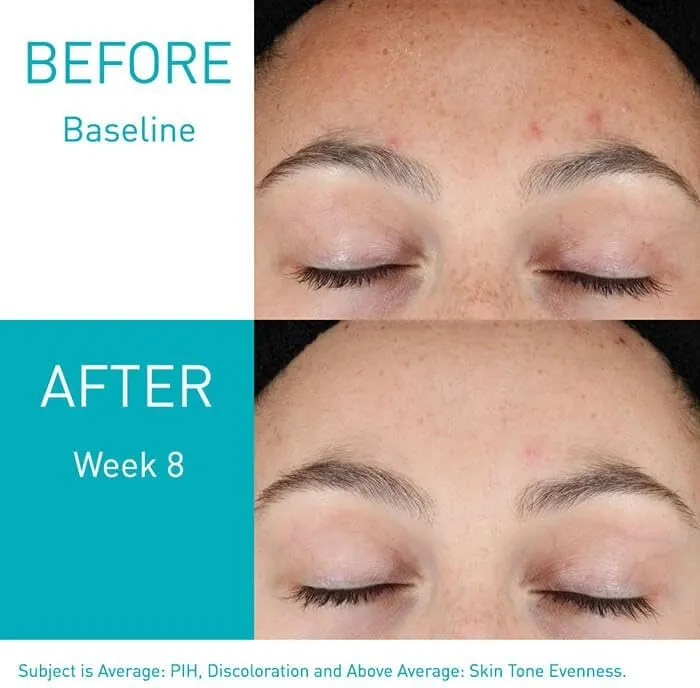 CERAVE Resurfacing Retinol Serum