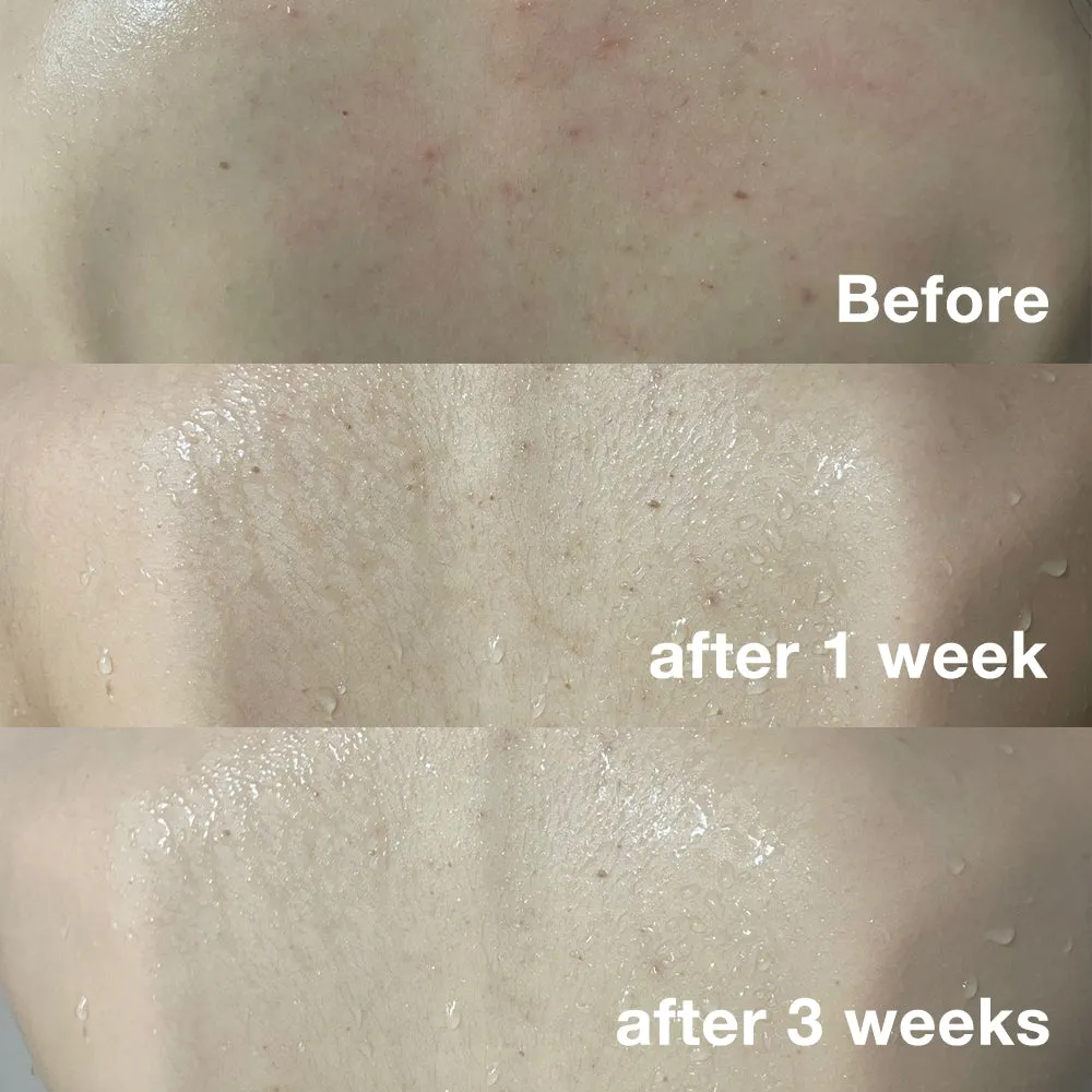Red Face & Body Cleansing Set