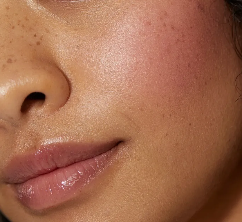 Vegan Cream Blush ? Orchid
